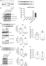 Tau Antibody in Western Blot (WB)