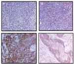 EGFR Antibody in Immunohistochemistry (IHC)