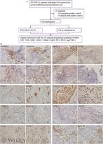 CD8 Antibody in Immunohistochemistry (IHC)