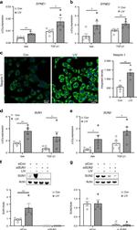 Nesprin 1 Antibody in Immunocytochemistry (ICC/IF)