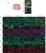Calbindin D28K Antibody in Immunohistochemistry (IHC)