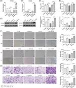SCN3B Antibody in Western Blot (WB)