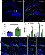 Zika Virus NS1 Antibody in Immunohistochemistry (IHC)