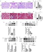 CD365 (TIM1) Antibody in Western Blot (WB)