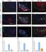 CD8 alpha Antibody in Immunohistochemistry (IHC)