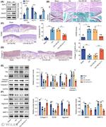 Aggrecan Antibody in Western Blot (WB)