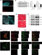 IL1R1 Antibody in Western Blot (WB)