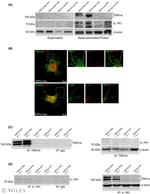 IL1R1 Antibody in Western Blot, Immunoprecipitation (WB, IP)