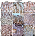 Peripherin Antibody in Immunohistochemistry (IHC)