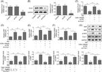 S1P1 Antibody in Western Blot (WB)
