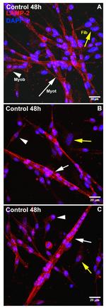LAMP2 Antibody in Immunocytochemistry (ICC/IF)