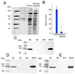 Bacillus Spore Antigen Antibody in Neutralization (Neu)
