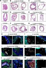 E. coli serotype O/K Polyclonal Antibody