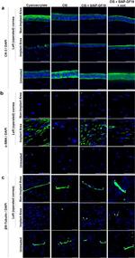 beta-3 Tubulin Antibody in Immunohistochemistry (IHC)