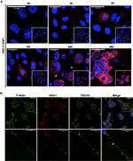 HSV Type 1 (strain F) Antibody in Immunocytochemistry (ICC/IF)