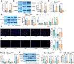 MMP13 Antibody in Western Blot (WB)
