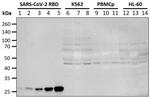 SARS-CoV-2 Spike Protein (RBD) Antibody in Western Blot (WB)