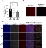 Thrombin Antibody in Immunohistochemistry (IHC)