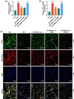 UCP1 Antibody in Immunocytochemistry (ICC/IF)