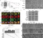 Calnexin Antibody in Immunocytochemistry (ICC/IF)