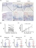 PSME3 Antibody in Immunohistochemistry (IHC)