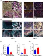 PSME3 Antibody in Immunohistochemistry (IHC)