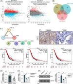 RPL5 Antibody in Immunohistochemistry (IHC)