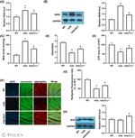Nrf2 Antibody in Western Blot (WB)