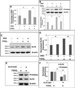 PEPD Antibody in Western Blot (WB)