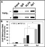 SP1 Antibody in ChIP Assay (ChIP)