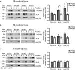 TSG101 Antibody in Western Blot (WB)