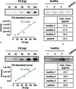 C8B Antibody in Western Blot (WB)