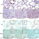 Porcine Circovirus Type 2 Capsid Antibody in Immunohistochemistry (IHC)