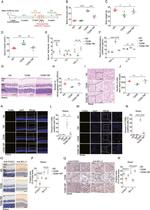 FOXD1 Antibody in Immunohistochemistry (IHC)