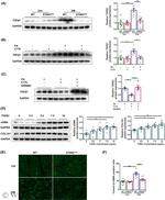 Procollagen I N-Peptide Antibody in Western Blot (WB)