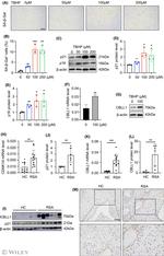 CBLL1 Antibody in Western Blot (WB)