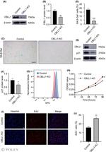 CBLL1 Antibody in Immunohistochemistry (IHC)