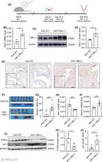 CBLL1 Antibody in Immunohistochemistry (IHC)