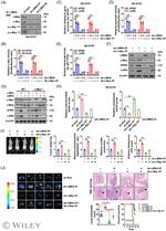 EPRS Antibody in Western Blot (WB)