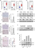 GINS1 Antibody in Western Blot (WB)