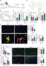 Grancalcin Antibody in Western Blot (WB)