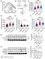 MARCKS Antibody in Western Blot (WB)