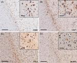 TIM-1 Antibody in Immunohistochemistry (IHC)