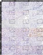 CD4 Antibody in Immunohistochemistry (IHC)