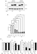 SLFN14 Antibody in Western Blot (WB)