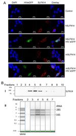 SLFN14 Antibody in Western Blot (WB)