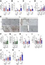 CD11a (LFA-1alpha) Antibody in Immunohistochemistry (IHC)