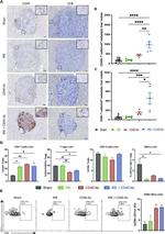 CD8a Antibody in Immunohistochemistry (IHC)