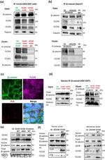 beta Catenin Antibody in Western Blot, Immunoprecipitation (WB, IP)