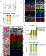 EOMES Antibody in Immunohistochemistry (IHC)